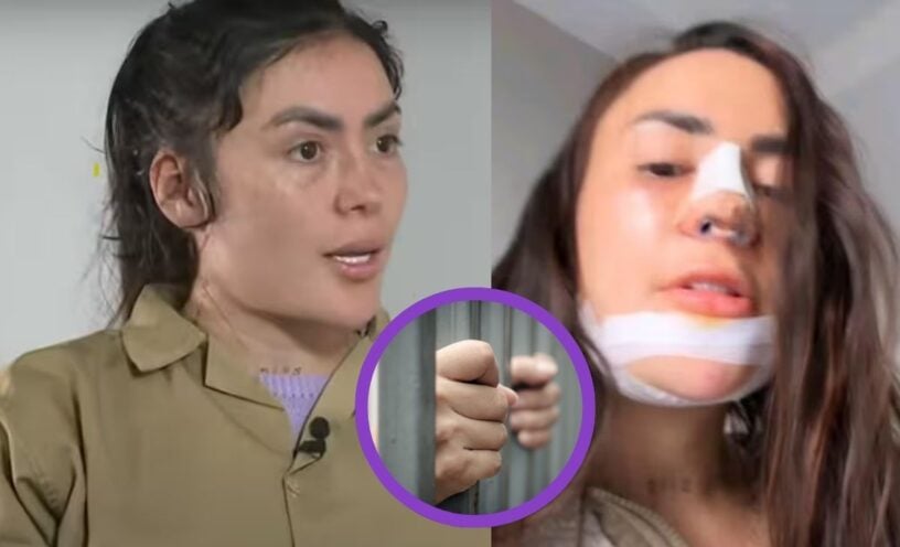 La foto del informe que revela que Epa Colombia se aplicó relleno de labios y glúteos dentro de la cárcel