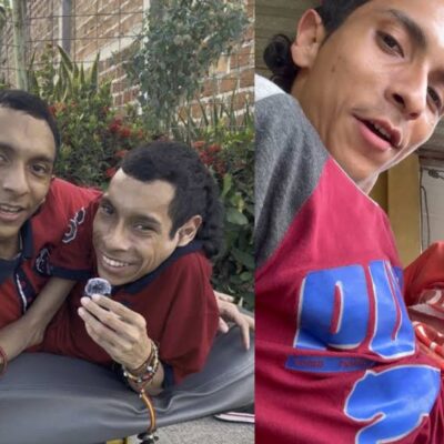 Murieron los hermanos siameses José Luis y José Armando Cevallos