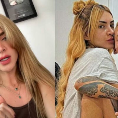 Dani Duke reapareció tras realizarse un procedimiento en su rostro
